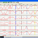 Looking For OBD-II Software and What Options To Consider